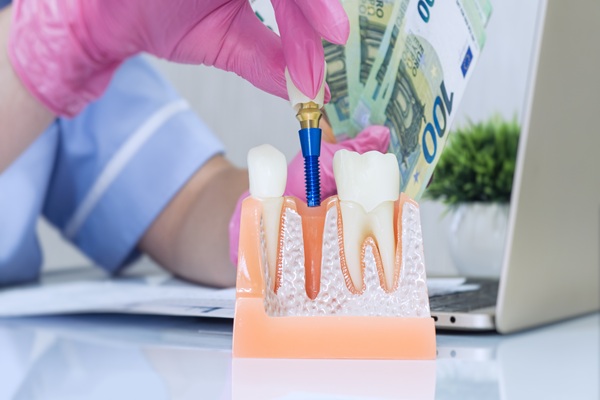 The Process Of Dental Implants: From Bone Grafting To Tooth Replacement